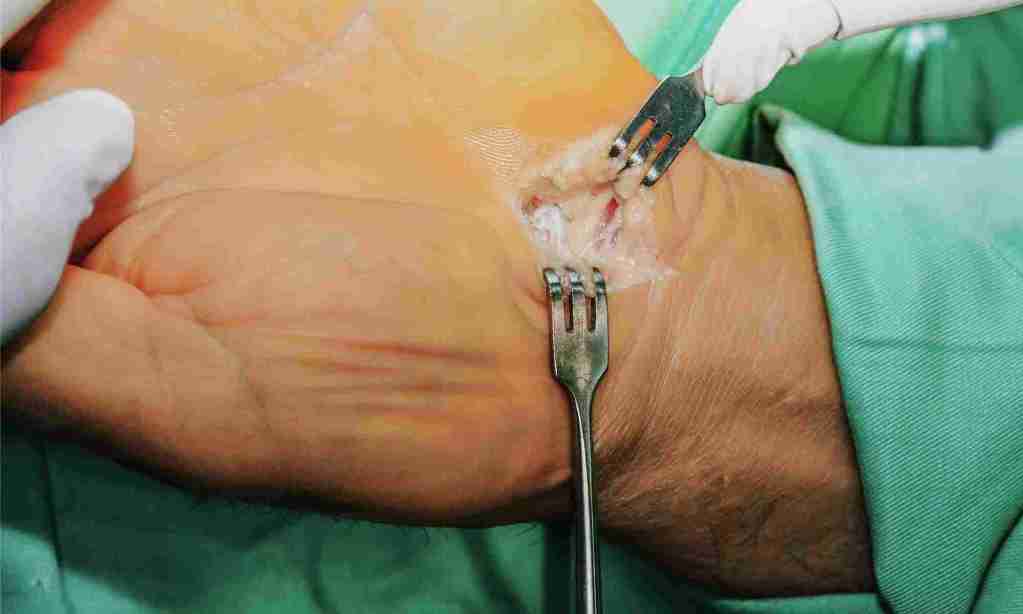 Hand Therapy Sydney treat post operative hand trauma