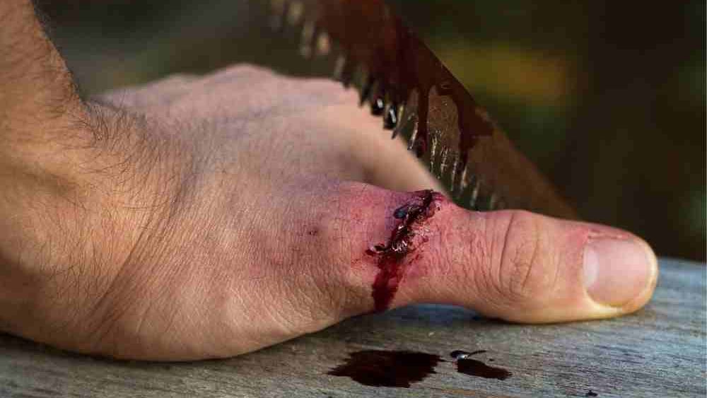 hand therapy for extensor tendon repair